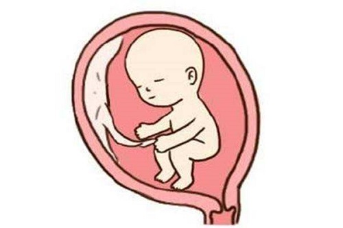 精子存在畸形怎么去做试管婴儿