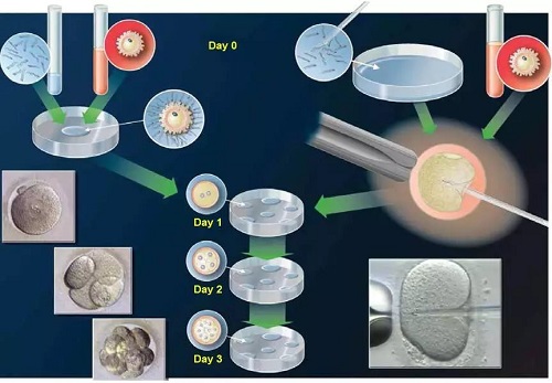 第四代试管婴儿技术究竟怎么样？看完马上清楚